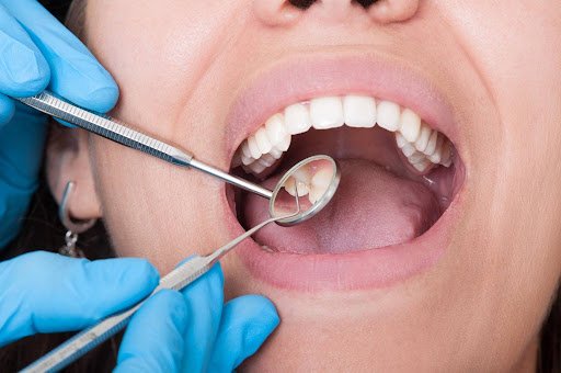 Dental Practice Financing Rates